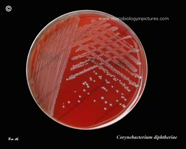 corynebacterium diphtheriae on blood agar plate, BAP